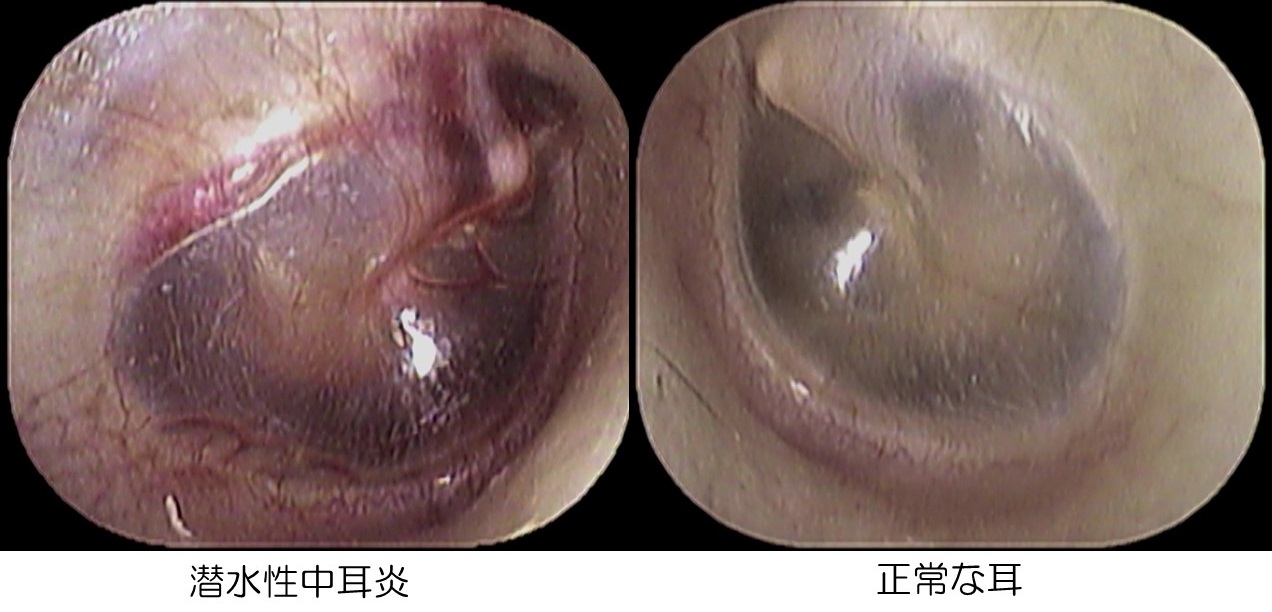 病気のはなし いのうえ耳鼻咽喉科